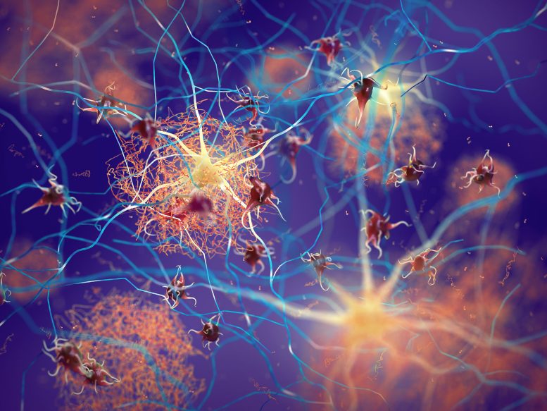 High-Fiber Diet Eases Alzheimer’s Symptoms by Calming Gut-Brain Axis, Study Finds