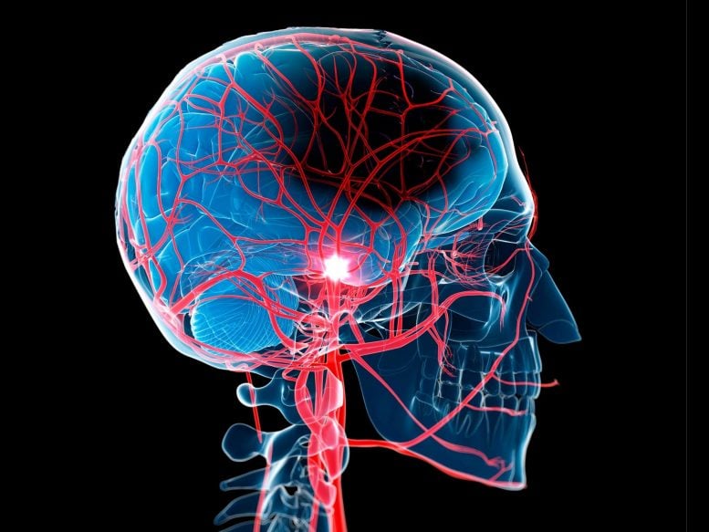 This Natural Compound Could Protect the Brain Against Stroke
