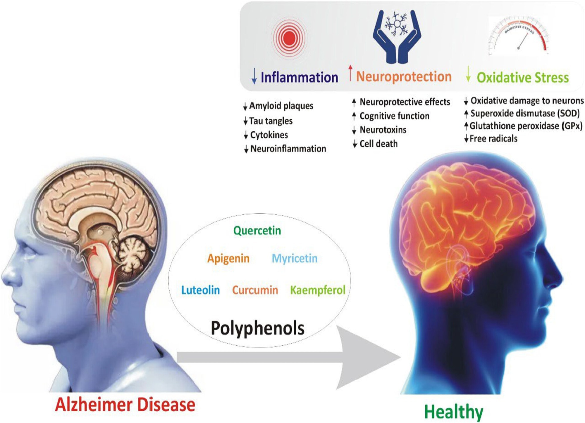 How plant compounds could target Alzheimer’s disease from multiple angles