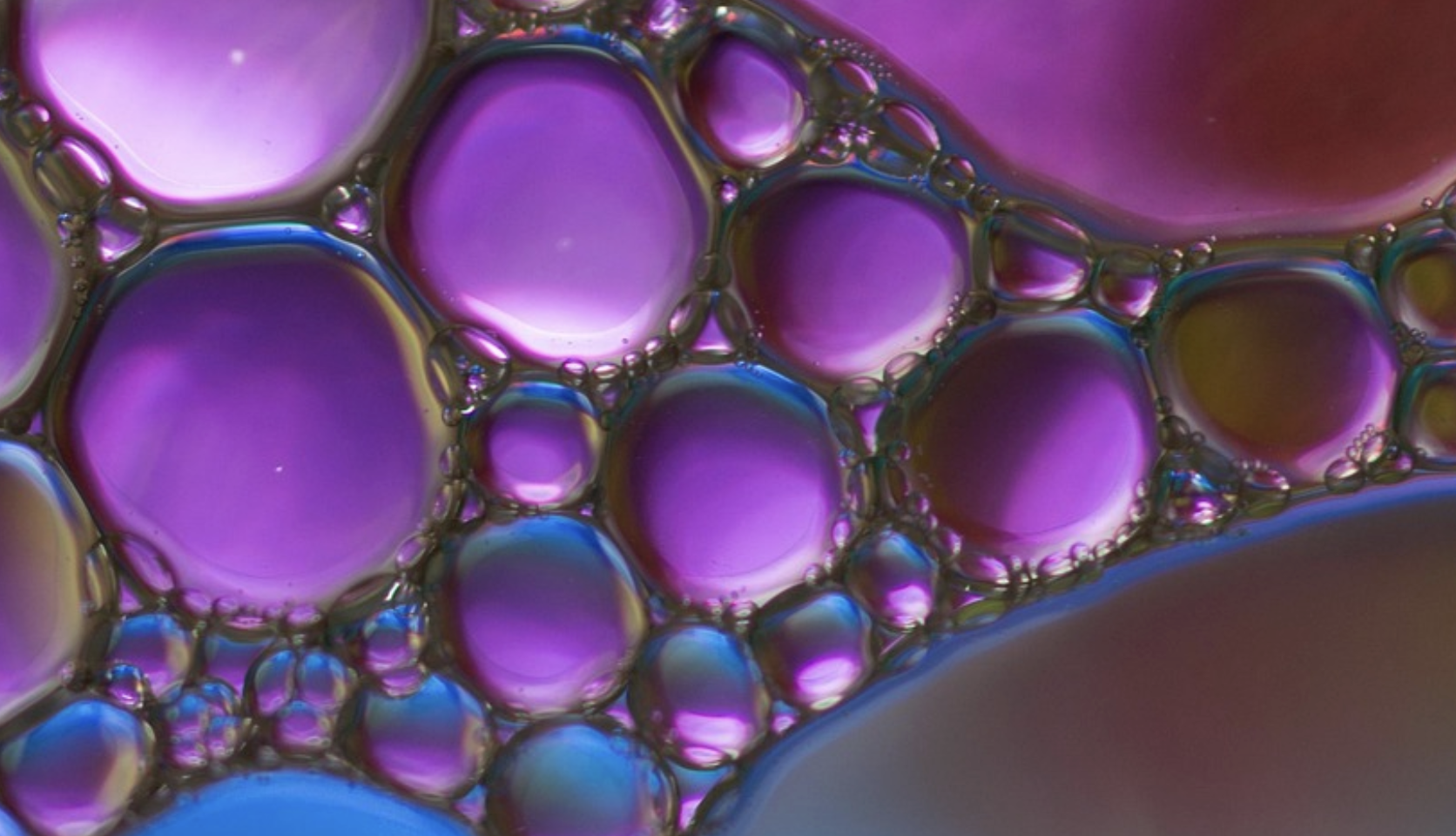 Gut Immune Cells Migrate to Brain & Are Linked to Alzheimer’s