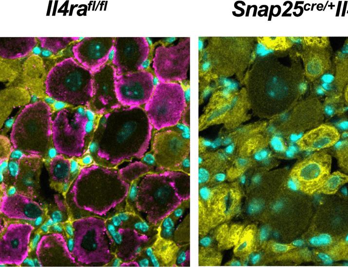 Group 2 innate lymphoid cells regulate nociceptive and gait functions of the peripheral nervous system | Science Immunology