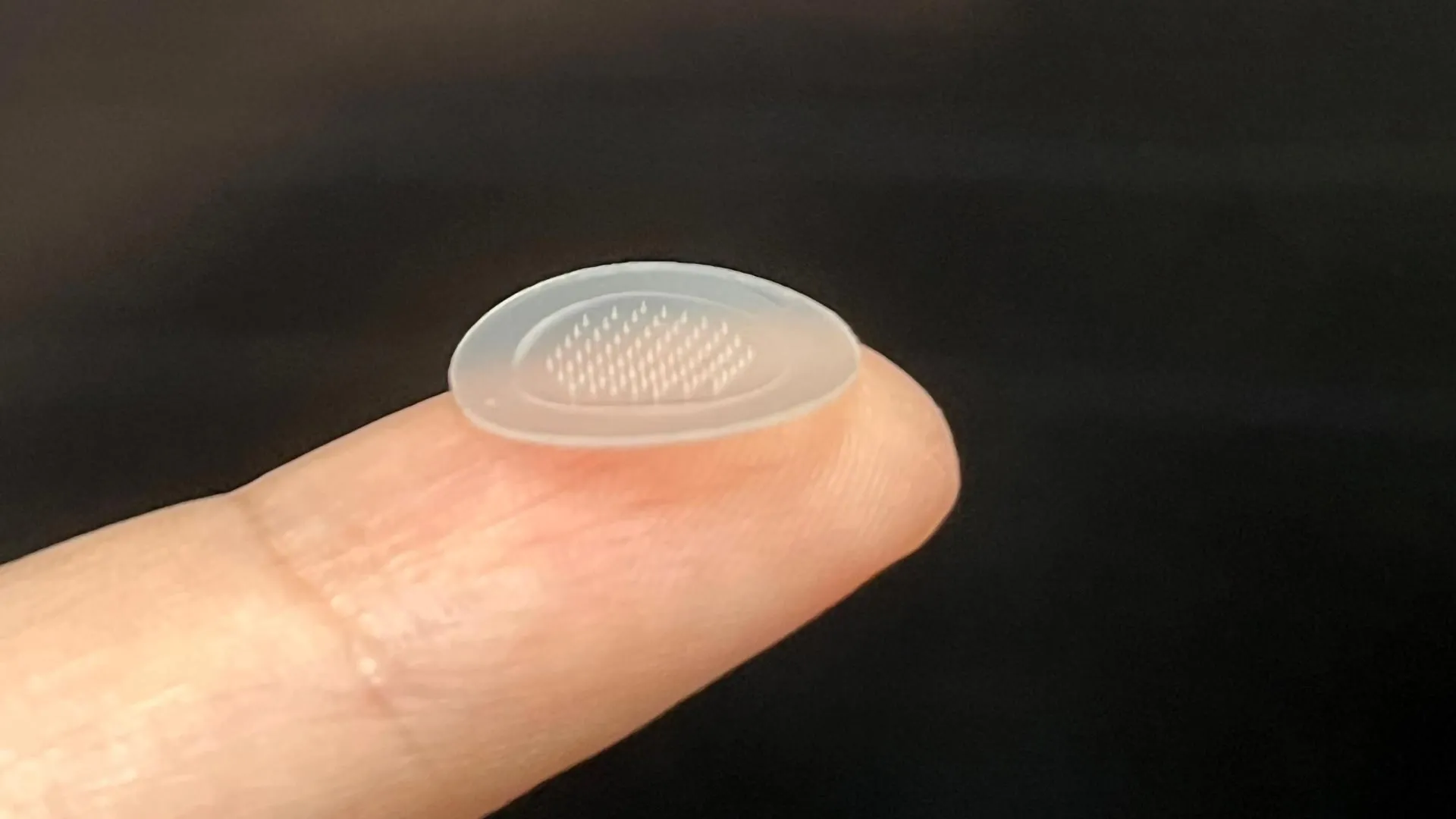 Clear skin in a week with this breakthrough acne patch