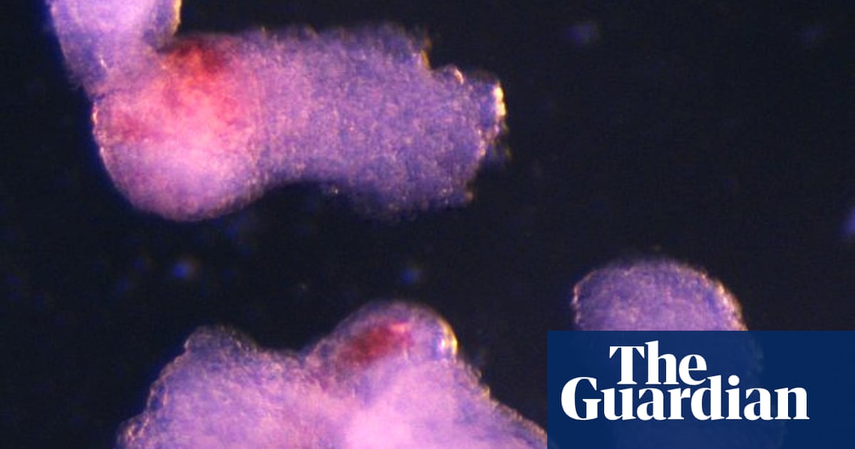 Lab-grown human embryo model produces blood cells | Science