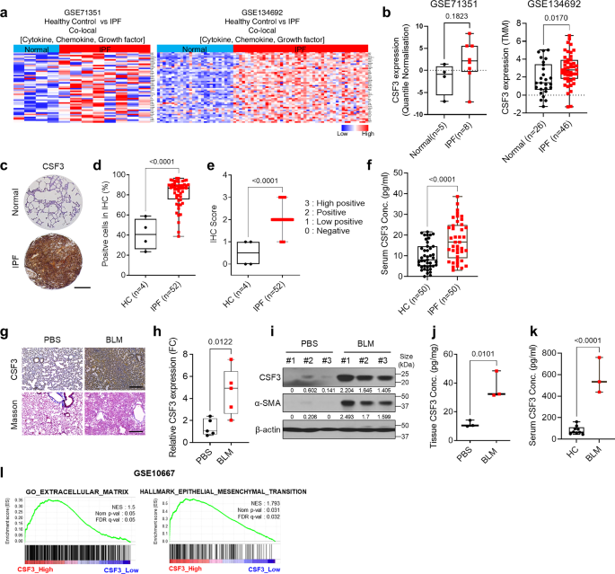 Colony-stimulating factor 3 as a key mediator in the progression of idiopathic pulmonary fibrosis: a novel therapeutic target