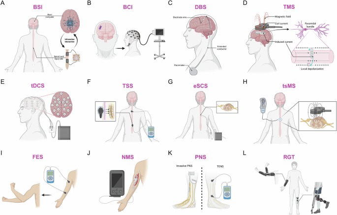 The effect of device-based neuromodulation on the motor recovery of patients with spinal cord injury