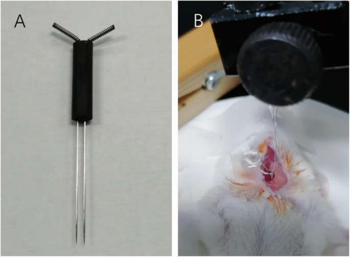 Electroacupuncture ameliorates Autism Spectrum Disorder via modulating the gut-brain axis depending on the integrity of vagus nerve