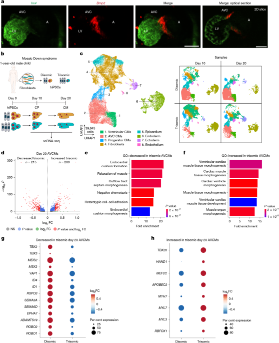 Myocardial reprogramming by HMGN1 underlies heart defects in trisomy 21