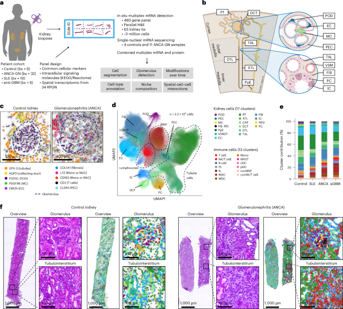 Spatiotemporal interaction of immune and renal cells controls glomerular crescent formation in autoimmune kidney disease