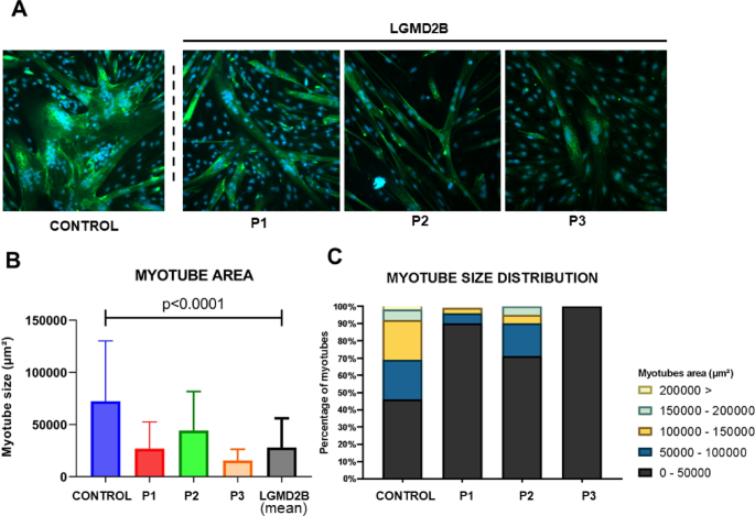 Impaired myogenesis in limb girdle muscular dystrophy type 2B