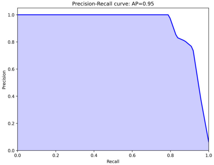 Machine learning approaches overcome imbalanced clinical data for intraoral free flap monitoring