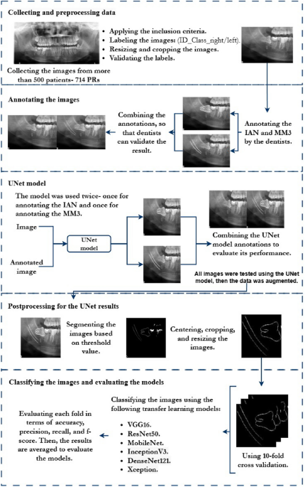 Automated assessment and detection of third molar and inferior alveolar nerve relations using UNet and transfer learning models