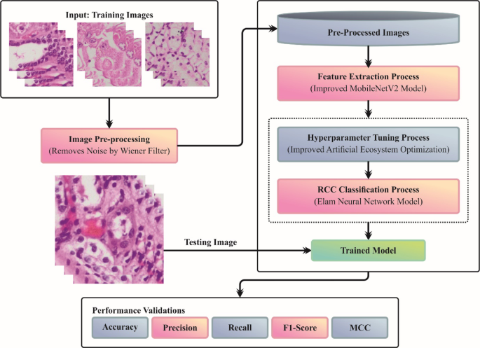 Exploiting deep transfer learning based precise classification and grading of renal cell carcinoma using histopathological images