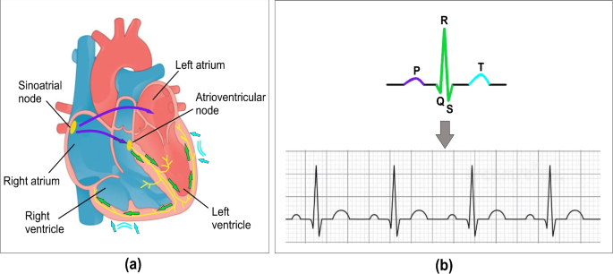 An integrated algorithm for single lead electrocardiogram signal analysis using deep learning with 12-lead data
