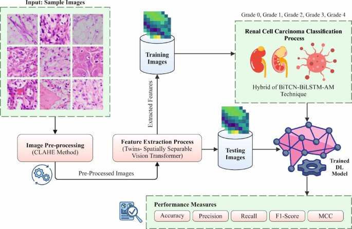 Advanced transformer with attention-based neural network framework for precise renal cell carcinoma detection using histological kidney images