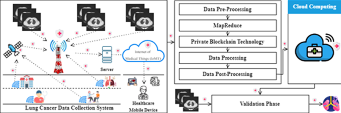 Secure and interpretable lung cancer prediction model using mapreduce private blockchain federated learning and XAI