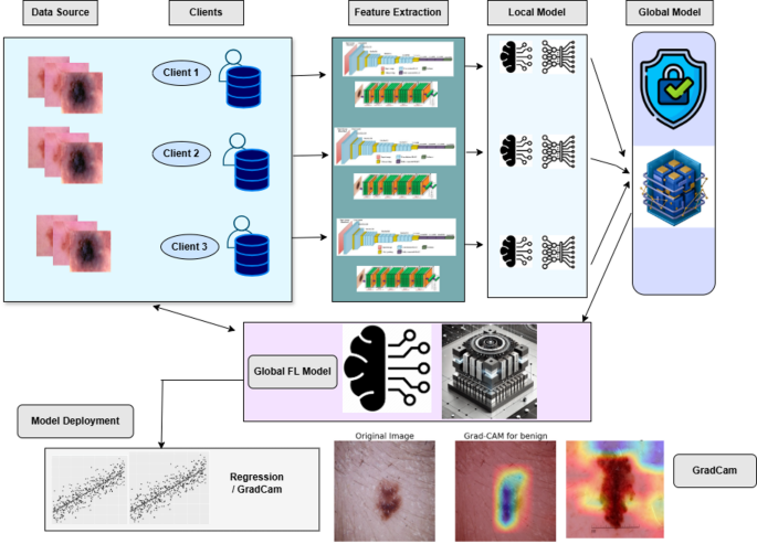 Privacy preserving skin cancer diagnosis through federated deep learning and explainable AI