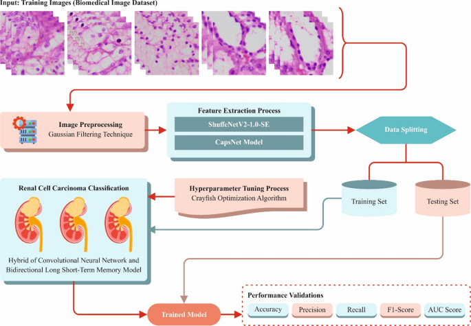 Computer vision assisted deep transfer learning model for accurate grading of renal cell carcinoma from kidney histopathology images