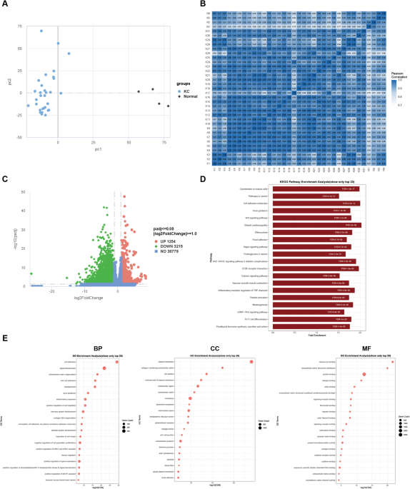 Transcriptomic profiling reveals neural–immune–stromal dysregulation and risk-associated gene signatures in advanced keratoconus