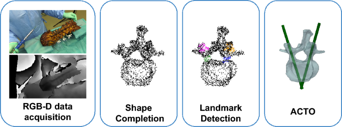 Feasibility of automatic screw planning via transformer-based shape completion from RGB-D imaging