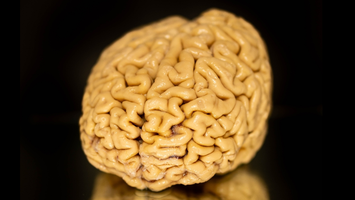 ‘Superager’ Brains Defy Cognitive Decline. We Finally Know Their Secret. : ScienceAlert
