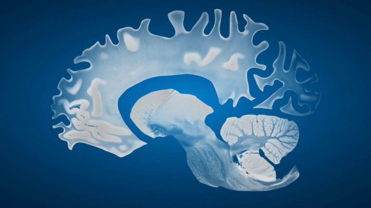 Male Brains Shrink Faster Than Female Brains, Study Finds : ScienceAlert