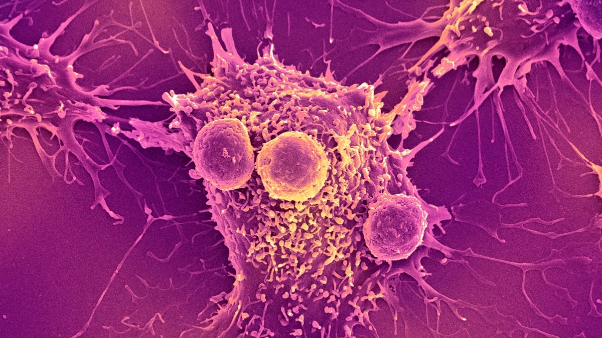 Cancer Vaccine Blocks Multiple Tumors in Mice For 250 Days : ScienceAlert