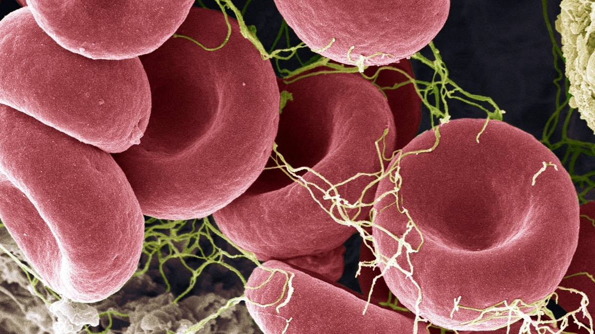 Can a New Blood Test Actually Detect ME/CFS? Here’s What We Know : ScienceAlert