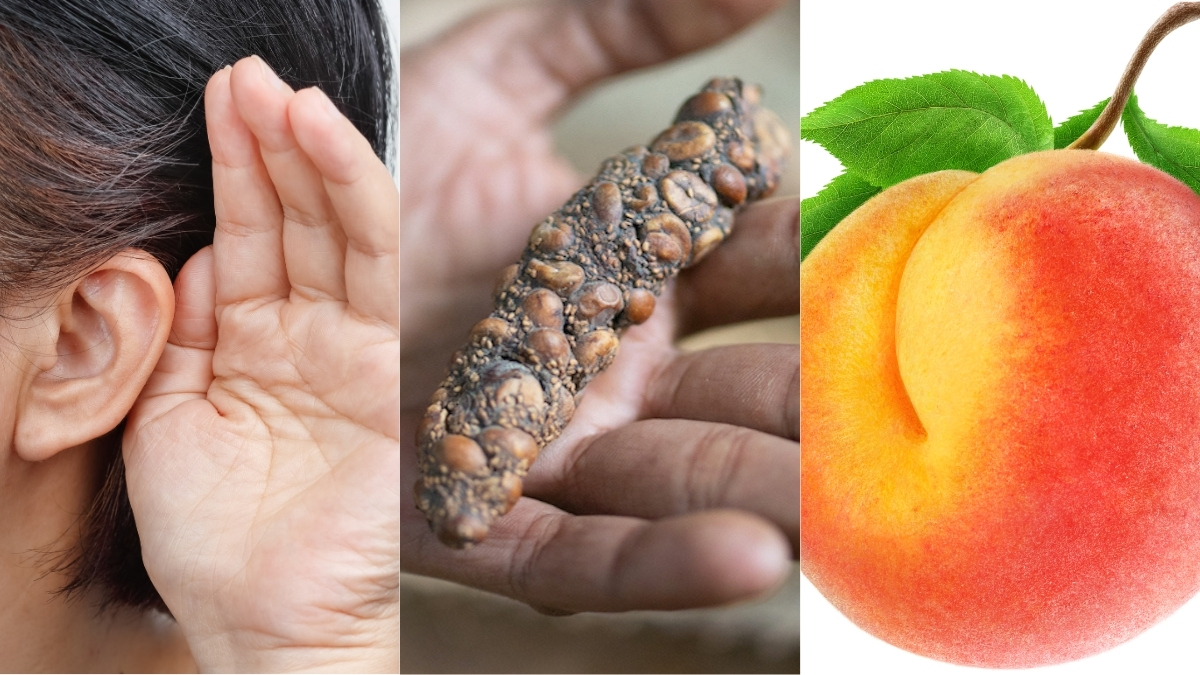 Hearing ‘Voices’, Poop Coffee, Butt Breathing, And More! : ScienceAlert