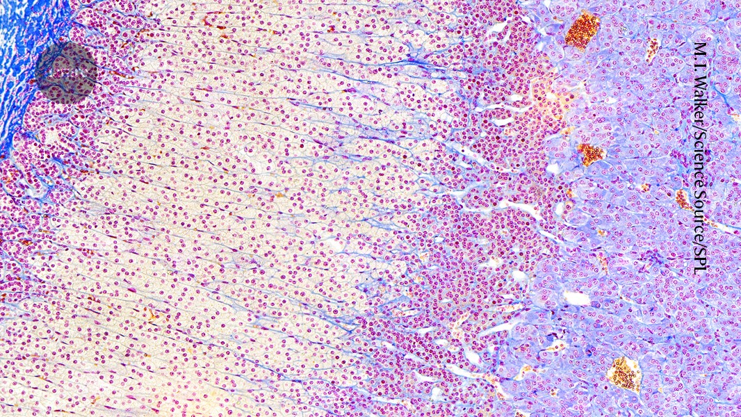 ‘Gland-in-a-dish’ secretes stress hormone like the real thing