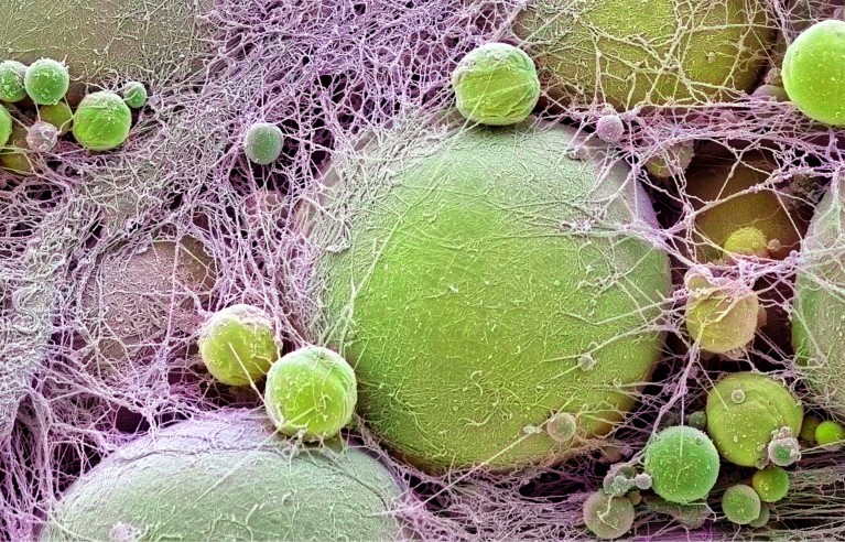 This gene causes obesity — and shields against heart disease