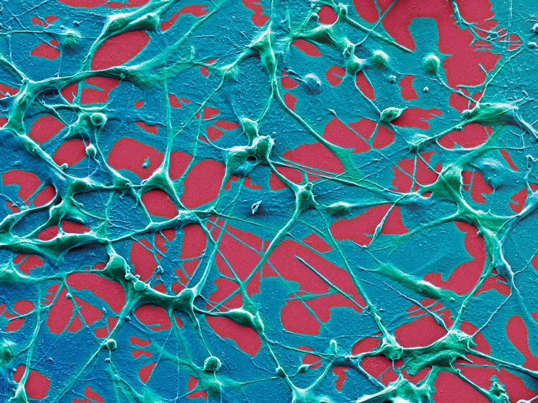 People with some cancers live longer after a COVID vaccine