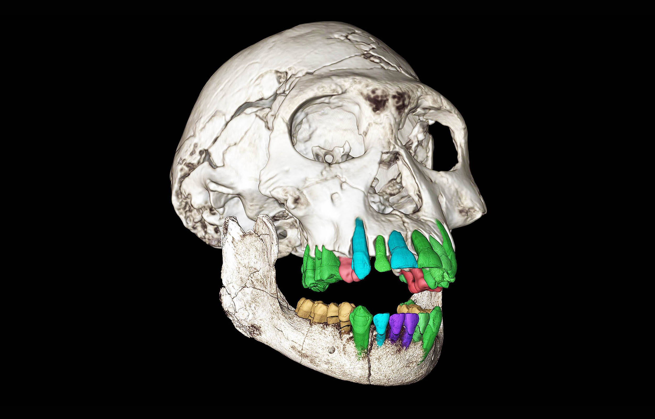 Fossil teeth reveal clues to why human childhood lasts so long