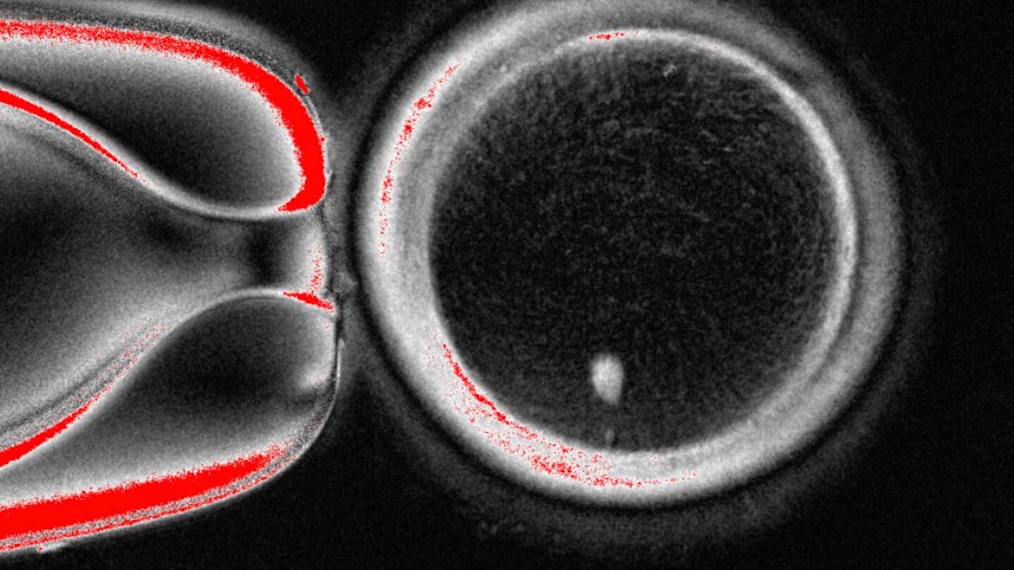 Scientists create fertilizable eggs from human skin cells in proof-of-concept experiment