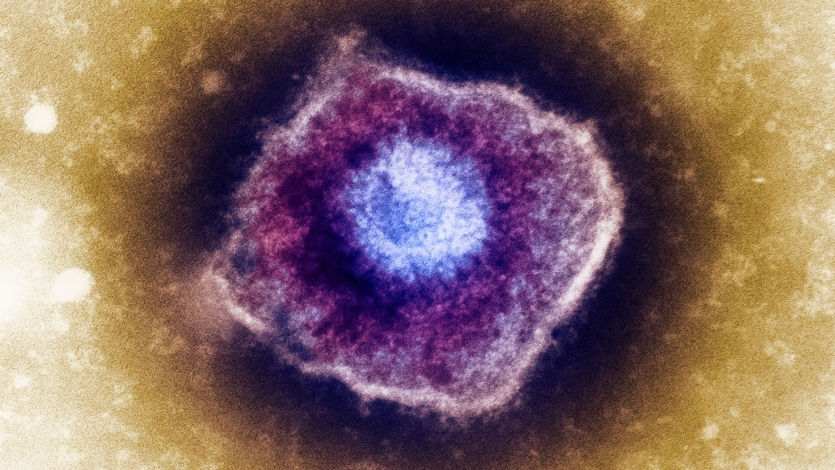 5 Shingles Myths Your Doctor Wants You to Stop Believing : ScienceAlert