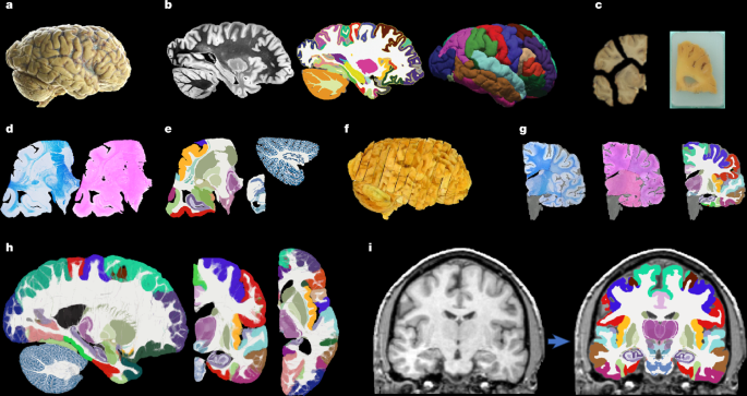 A probabilistic histological atlas of the human brain for MRI segmentation