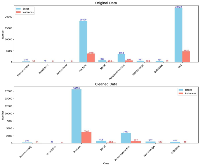Artificial intelligence-based method for detecting wrist fractures in children