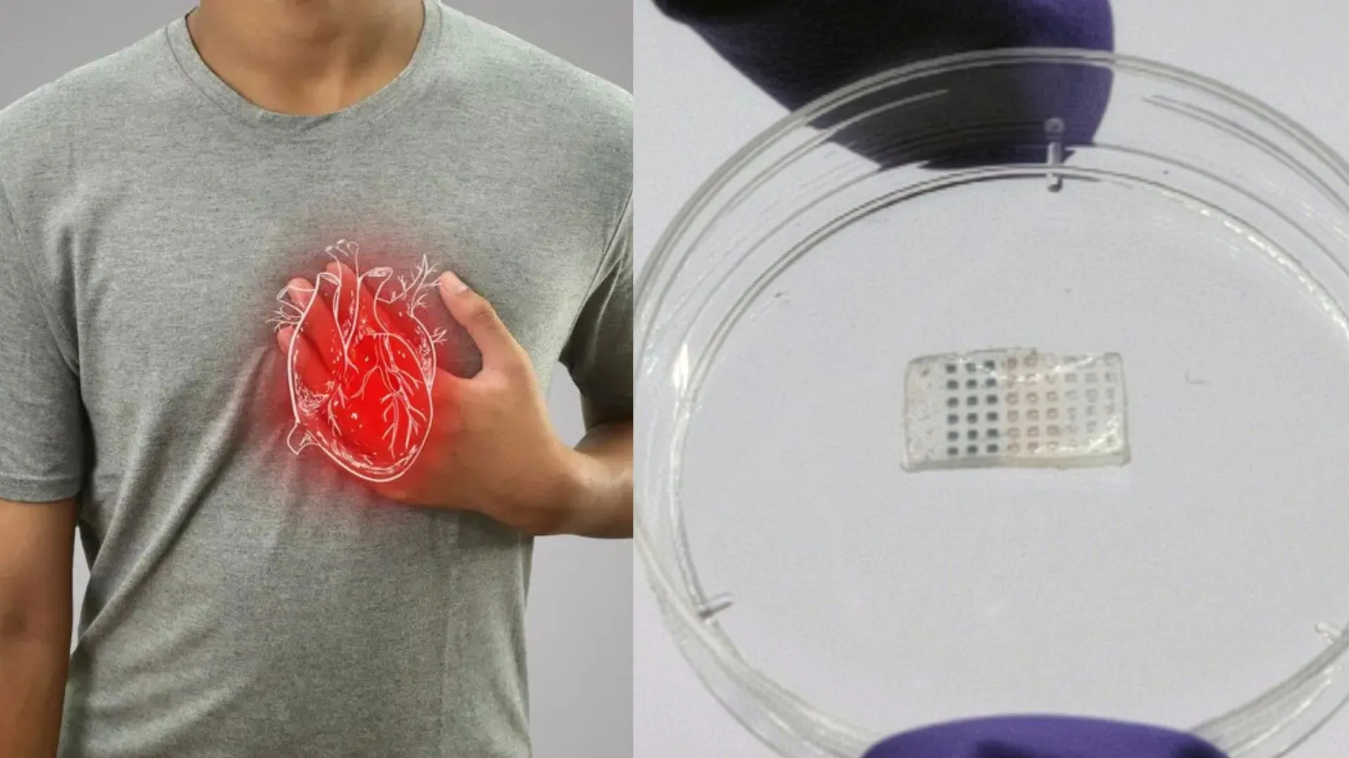 Smart heart patch cuts damage by 50% after major heart attack