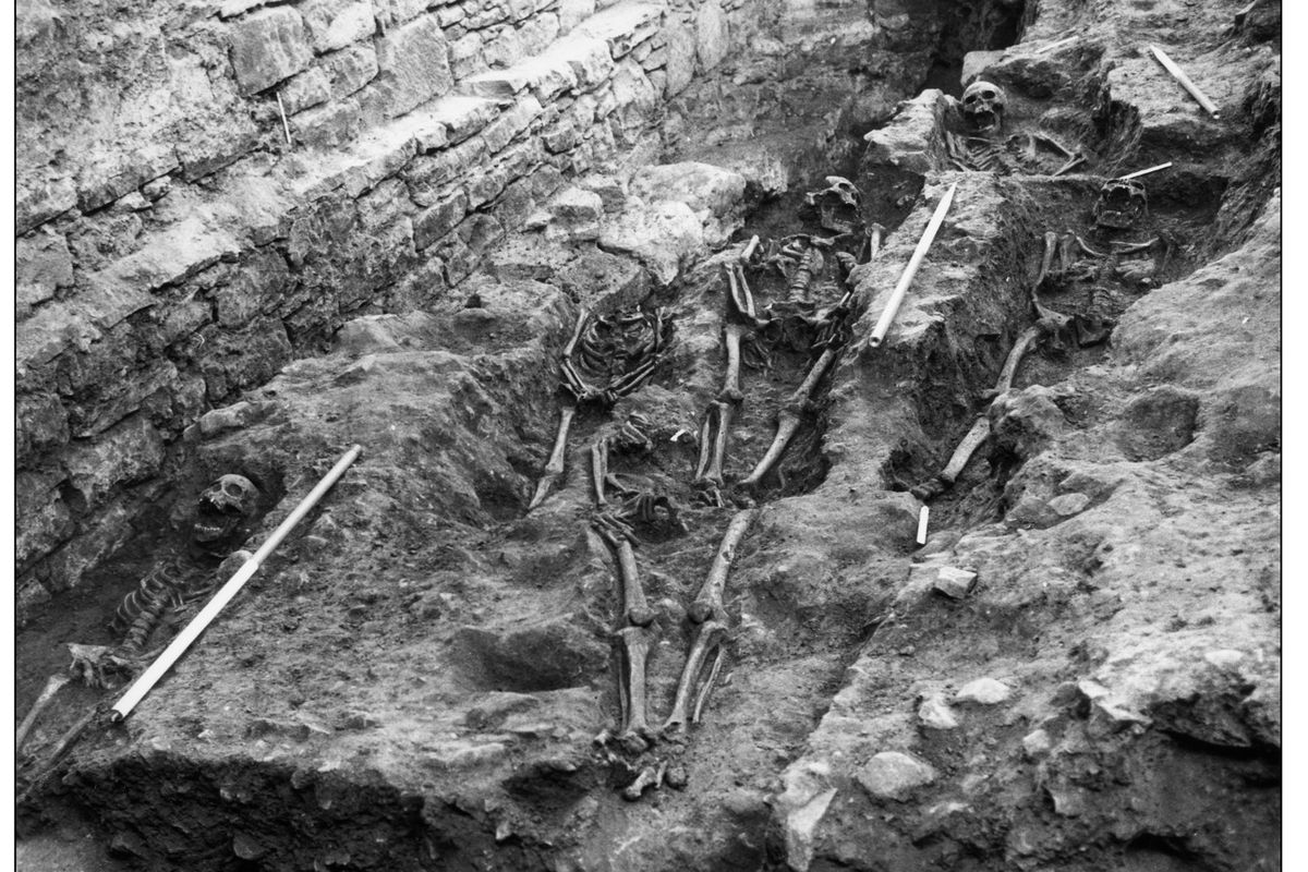 14th Century Tooth Reveals Grim Fate of Edinburgh Teen Killed by the Black Death