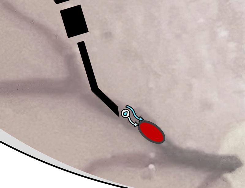 Deep learning–based autonomous retinal vein cannulation in ex vivo porcine eyes | Science Robotics