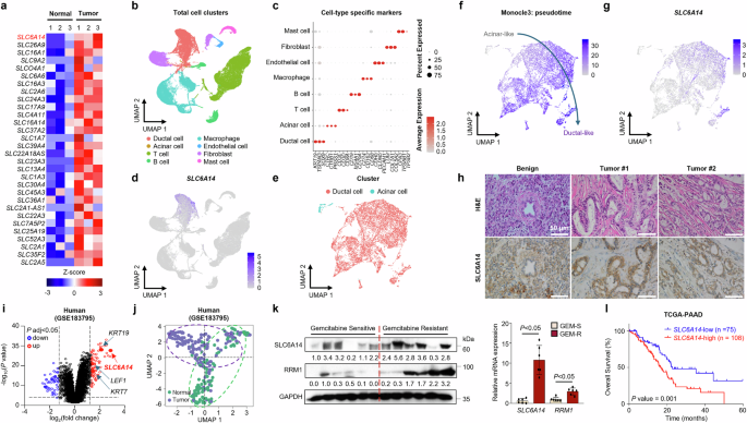 SLC6A14-mediated glutamine promotes SYTL4–CXCL8 axis activation to drive gemcitabine resistance and immune evasion in pancreatic cancer
