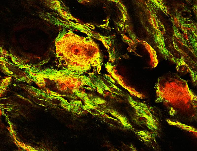 An orally bioavailable MrgprX1-positive allosteric modulator alleviates certain neuropathic pain–related behaviors in humanized mice | Science Translational Medicine