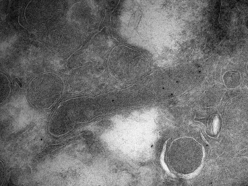 Bacteria on the Brain – Life Sciences | Weizmann Wonder Wander