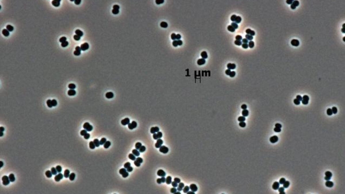 This Microbe ‘Plays Dead’ in NASA Clean Rooms, and We May Have Sent It to Mars