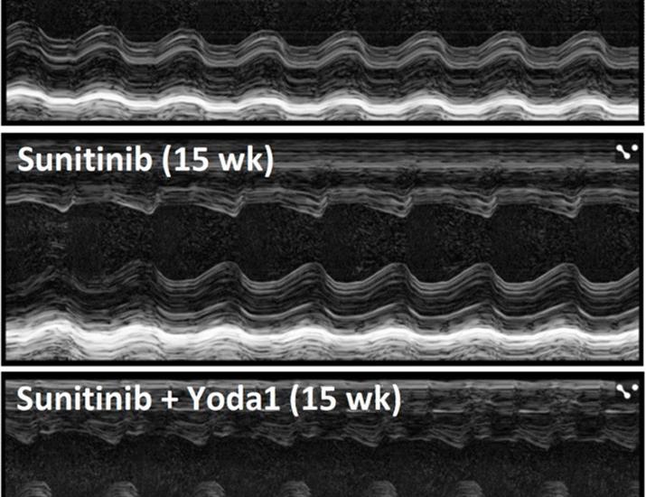Multiscale profiling of tyrosine kinase inhibitor cardiotoxicity reveals mechanosensitive ion channel PIEZO1 as cardioprotective | Science Translational Medicine