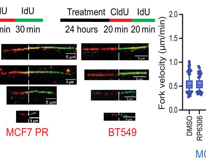 Rb1 deficiency induces synthetic lethality with ATR and PKMYT1 coinhibition in breast cancer cell lines and patient-derived xenografts | Science Translational Medicine