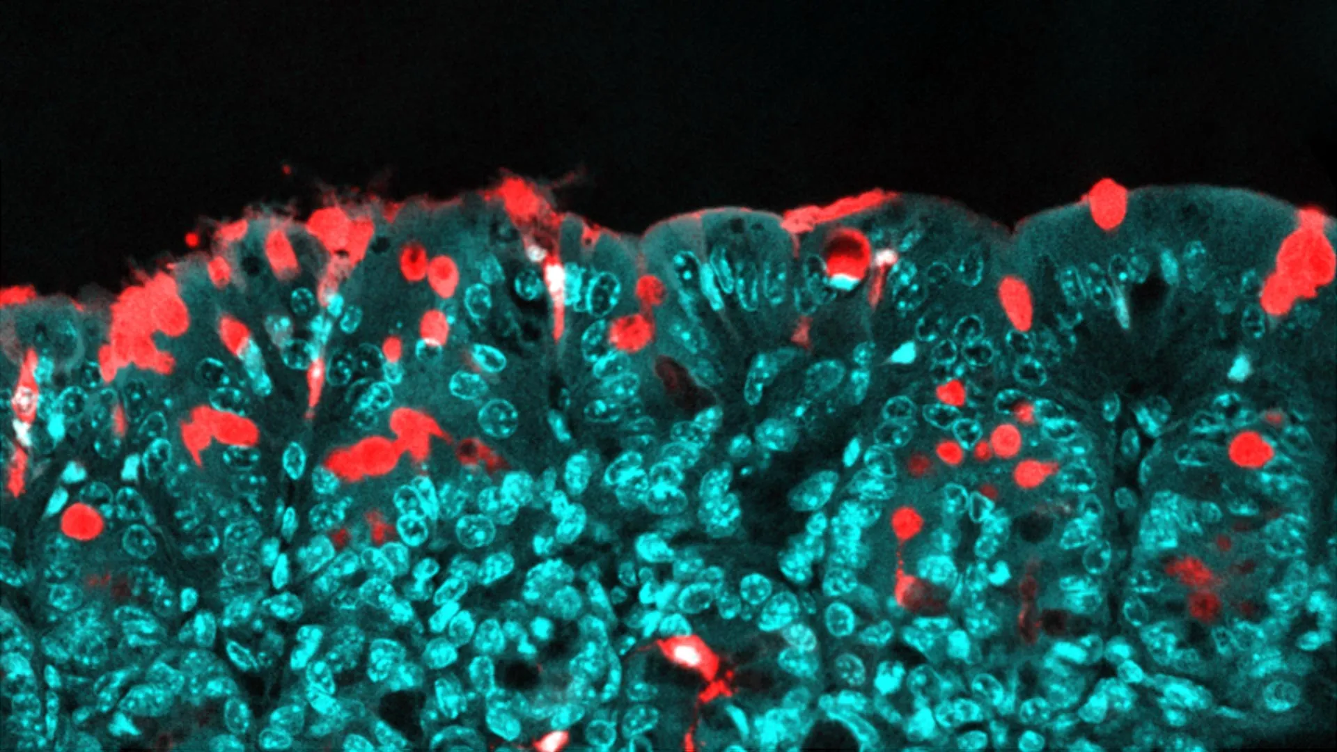 This common food ingredient may shape a child’s health for life