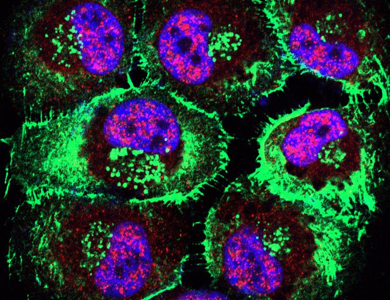 SREBP-1 increases glucose uptake to promote tumor resistance to lysosome inhibition | Science Translational Medicine