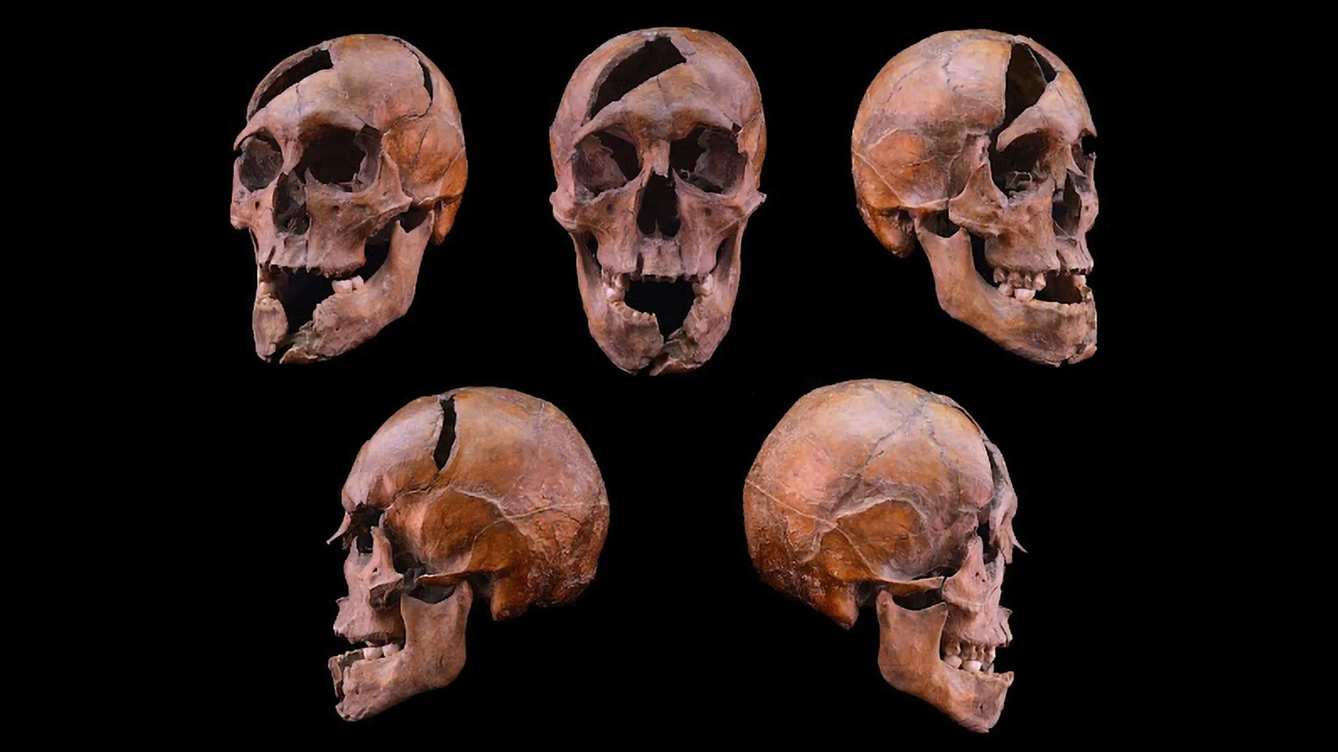 Science finally solves a 700-year-old royal murder