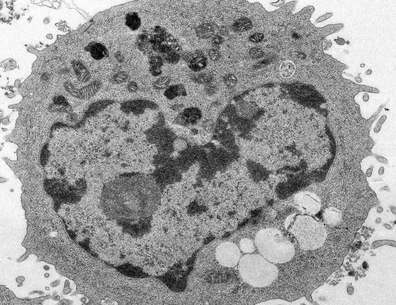 PTMA safeguards mitochondrial integrity to sustain metabolic function and antitumor activity of CD8 T cells | Science Immunology