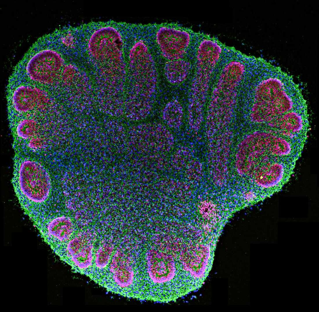 Brain organoids are helping researchers, but raise ethical questions : Shots